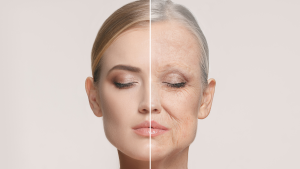 Illustration showing glycation effects on facial aging